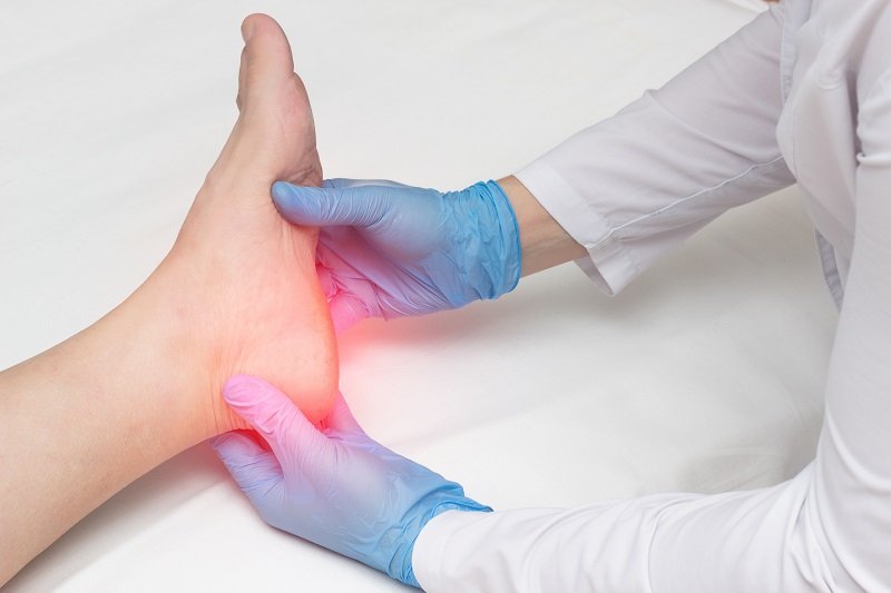 Plantar Fasciitis Explained: Causes & Relief - Colony Insoles