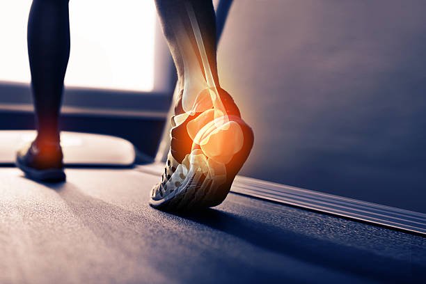 Foot Conditions Glossary - Colony Insoles
