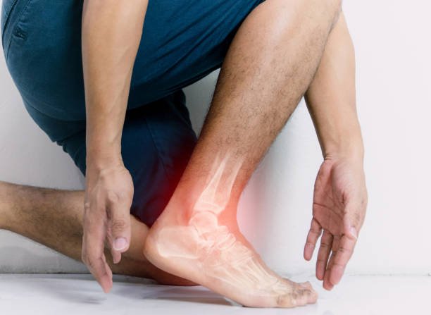 Foot Conditions Glossary - Colony Insoles