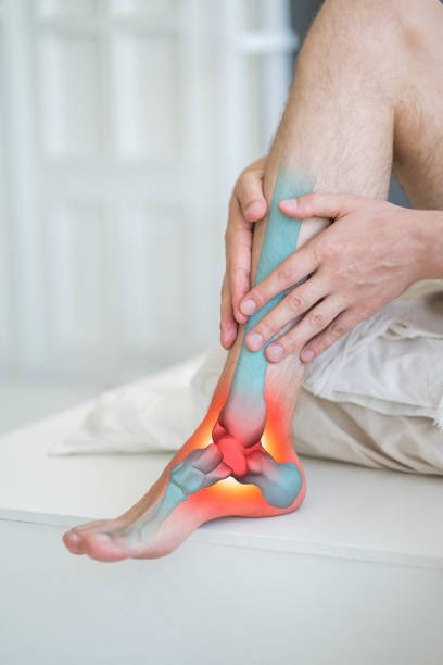 Plantar Fasciitis Explained: Causes & Relief - Colony Insoles